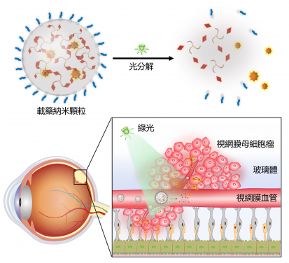 The research team developed a green light-responsive nanocarrier based on the self-assembly of photocleavable three-legged molecules. After intravenous injection of drug-loaded nanocarriers, the light-triggered drug release in retinoblastoma exhibited significant anticancer efficacy and minimal side effects.
 